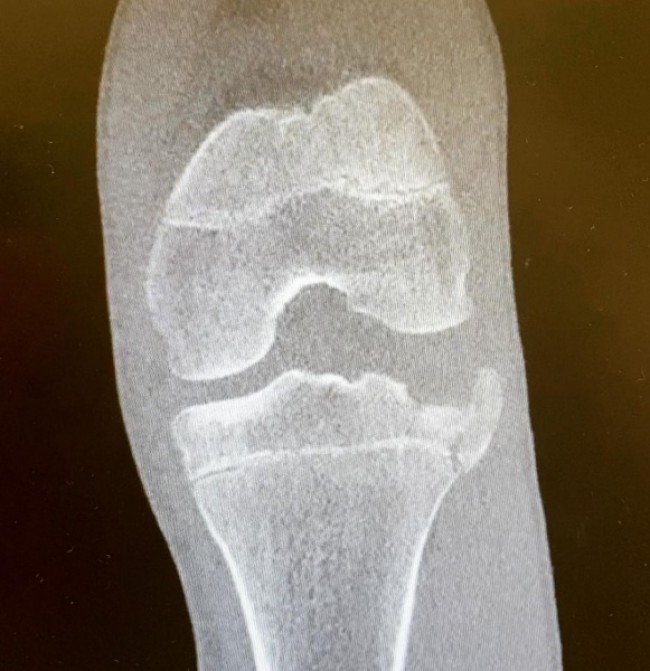 Jetzt eine Knieverletzung für Niels Wennemars